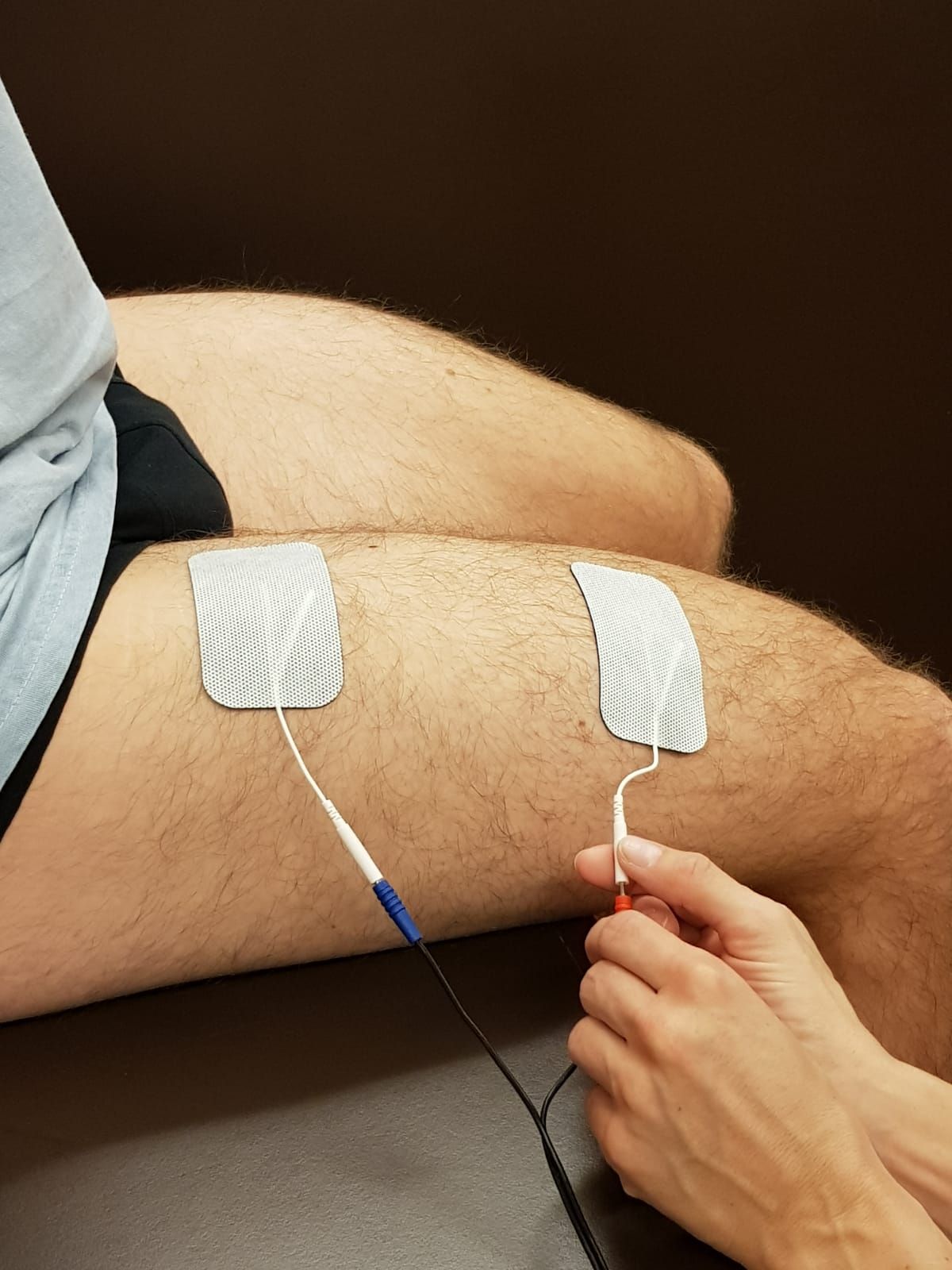 Transcutaneous electrical  stimulation of the quadriceps  muscles