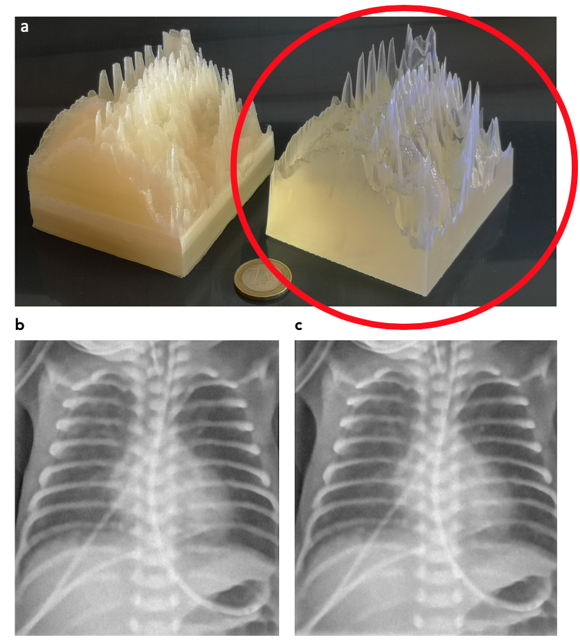 Vergleich von Phantomen mit ihren Röntgeaufnahmen