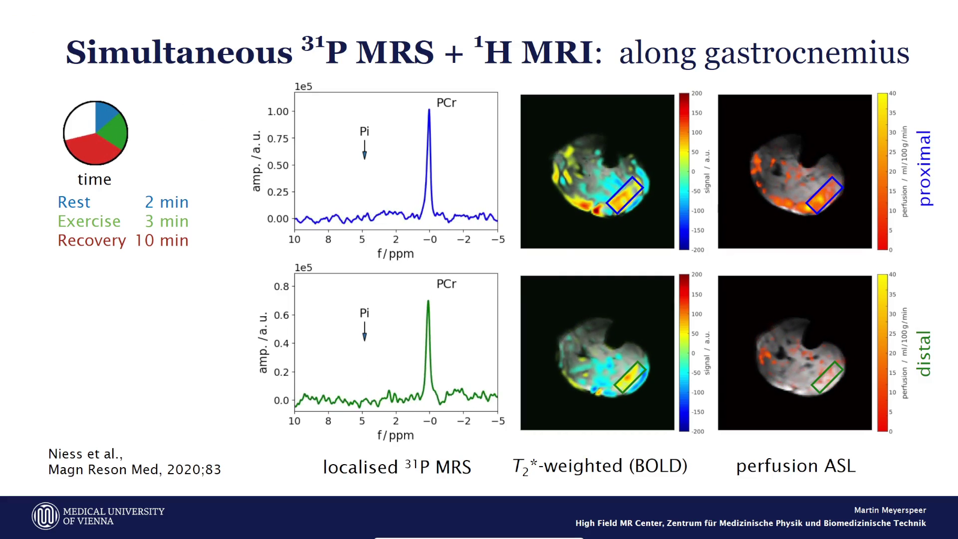 Gleichzeitige zeitaufgelöste 31P MRS und 1H MRI im Muskel